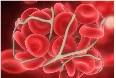 微量元素检测仪分析铁元素是怎么样产于造血过程