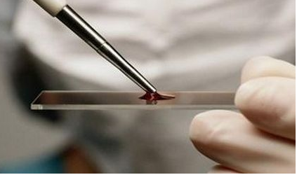 血液微量元素分析仪厂家血液检测是优中之优临床检测为人信服一种检测方法