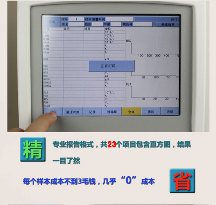 血细胞分析仪细节图