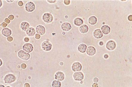 血细胞分析仪检测中白细胞三分群是什么