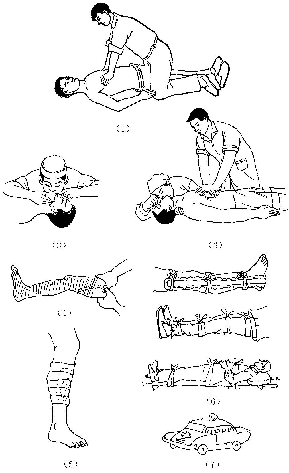 骨密度仪检测中心研究发现骨折治疗的主要方面有哪些?