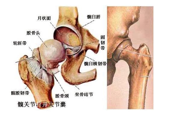 621山东国康骨密度仪解释说明什么是股骨头坏死?